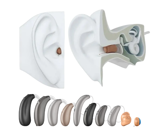 Signia Hearing Aid