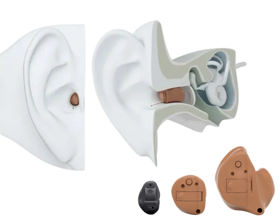 Signia Hearing Aid
