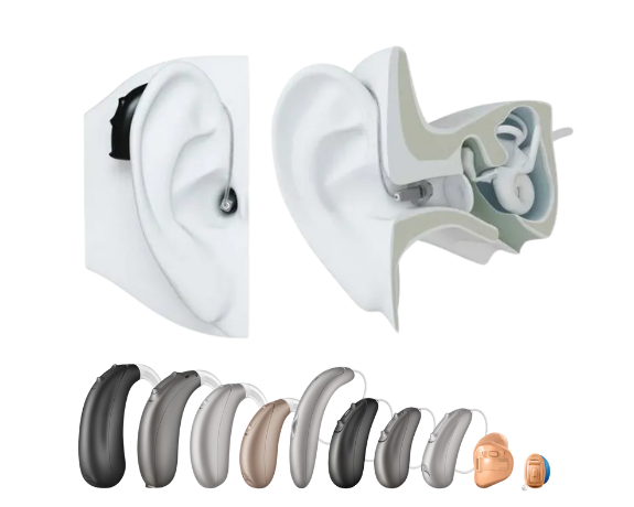 Signia Hearing Aid